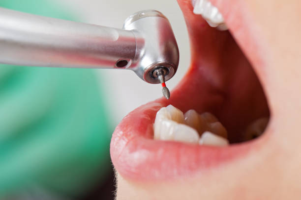 Best Pediatric Emergency Dentist in Hailey, ID